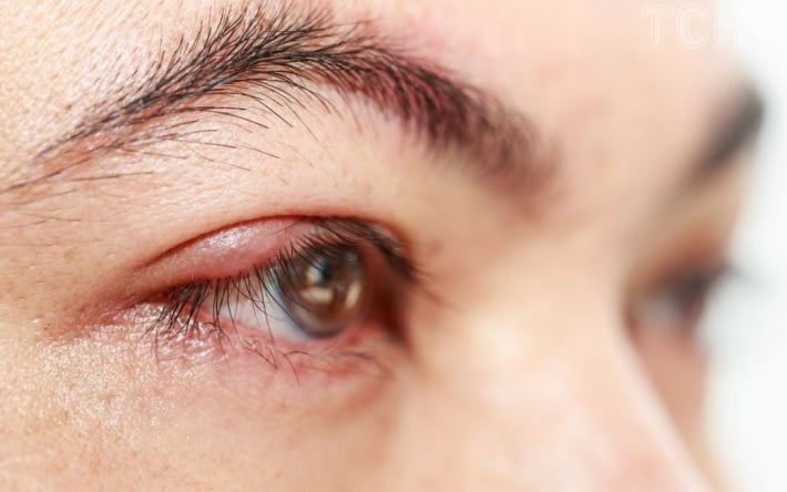 Чим небезпечна звичка терти очі: фахівці попередили про серйозні наслідки